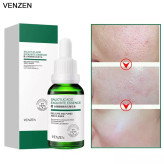 سرم صورت ونزن (Venzen) مدل Salicylic Acid ضد لک و جوش صورت