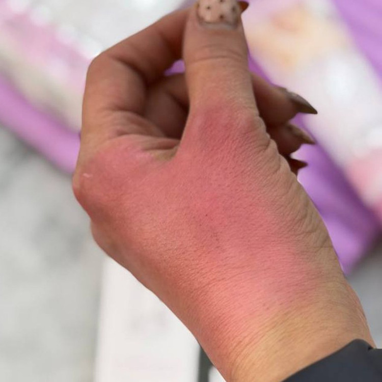 کرم صورتی و سفید کننده بدن و نواحی حساس یارا