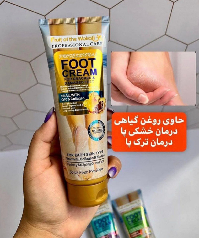 کرم ترک و خشکی پا وکالی